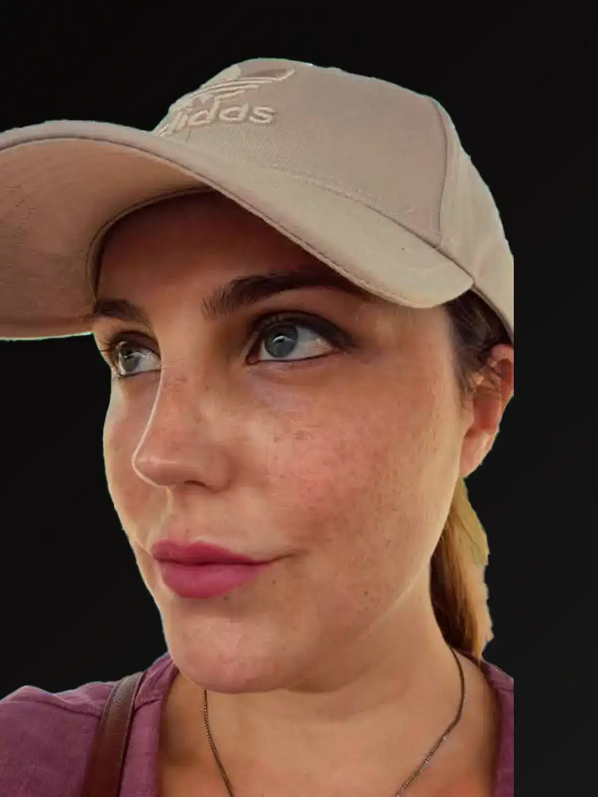 Después — Caso 2 — Perfil, secundaria