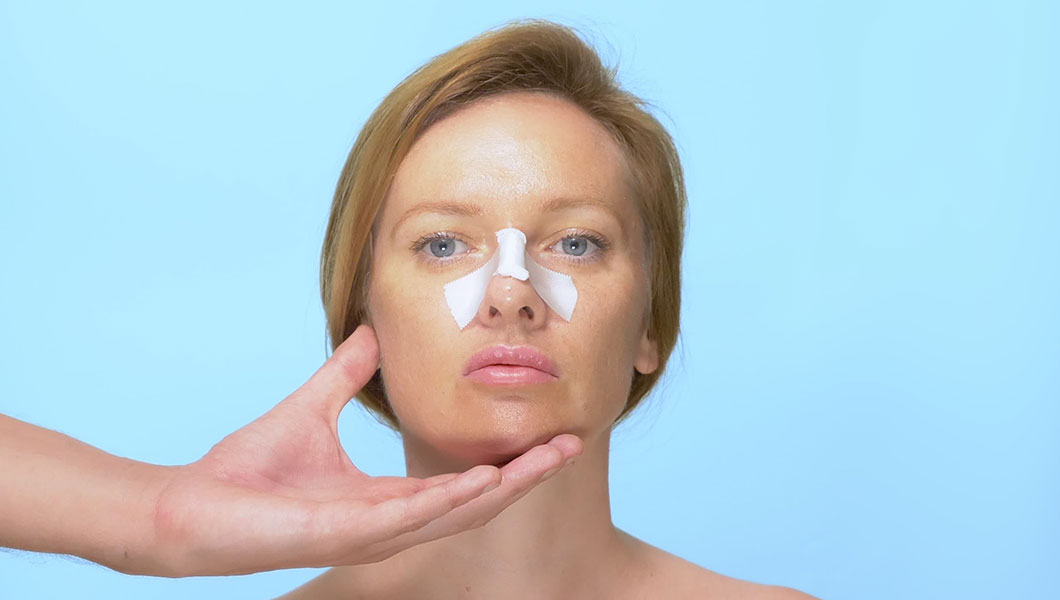 ¿Cómo es el postoperatorio de la rinoplastia ultrasónica?