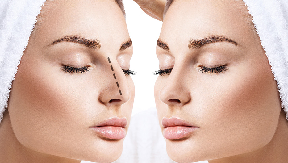 Rinoplastia en Sevilla: En qué consiste la operación